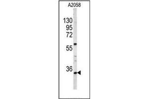 Image no. 1 for anti-Homeobox A9 (HOXA9) (AA 243-272), (C-Term) antibody (ABIN952776)
