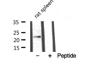 anti-Lymphotoxin beta (TNF Superfamily, Member 3) (LTB) (C-Term) antibody