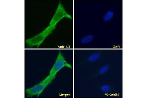 Image no. 6 for anti-Mast/stem Cell Growth Factor Receptor (KIT) (Internal Region) antibody (ABIN1589992)
