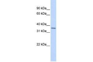 Image no. 1 for anti-T-Cell Leukemia Homeobox 1 (TLX1) (Middle Region) antibody (ABIN2792533)