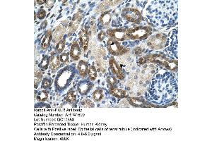 Image no. 2 for anti-Pyruvate Kinase, Liver and RBC (PKLR) (N-Term) antibody (ABIN2776945)