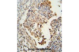 Image no. 1 for anti-Cell Adhesion Molecule 1 (CADM1) (AA 69-98), (N-Term) antibody (ABIN951001)