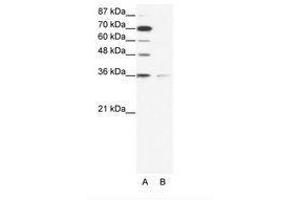 Image no. 1 for anti-Zinc Finger Protein 326 (ZNF326) (AA 469-518) antibody (ABIN203092)