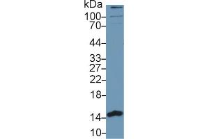 Image no. 2 for anti-phosphohistidine Phosphatase 1 (PHPT1) (AA 1-125) antibody (ABIN1176627)