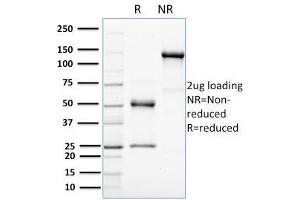 Image no. 1 for anti-V-Erb-A erythroblastic Leukemia Viral Oncogene Homolog 4 (Avian) (ERBB4) (AA 1116-1269) antibody (ABIN6939332)