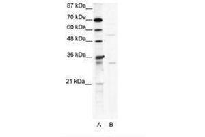 Image no. 1 for anti-TRIM17 / RNF16 (TRIM17) (AA 381-430) antibody (ABIN203174)