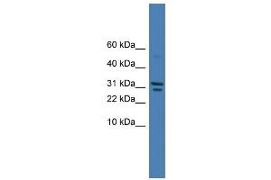Image no. 1 for anti-serine Peptidase Inhibitor, Kunitz Type, 2 (SPINT2) (C-Term) antibody (ABIN2787962)