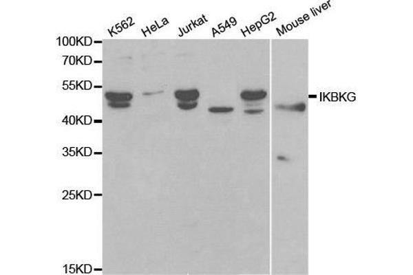 IKBKG Antikörper  (AA 1-419)