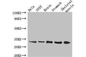 Connexin 31 anticorps  (AA 211-270)