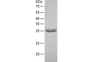 GTF2E2 Protein (AA 1-291) (His tag)