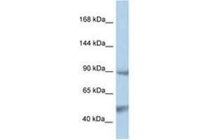 Image no. 1 for anti-Protein tyrosine Phosphatase, Non-Receptor Type 3 (PTPN3) (AA 106-155) antibody (ABIN6747346)