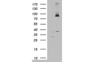 Image no. 4 for anti-ATP-Binding Cassette, Sub-Family D (Ald), Member 1 (ABCD1) (AA 508-745) antibody (ABIN2715621)