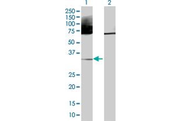 anti-Major Histocompatibility Complex, Class II, DR beta 3 (HLA-DRB3) (AA 1-266) antibody