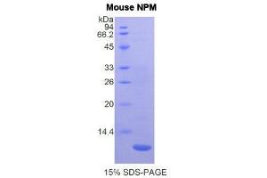Image no. 1 for Nucleophosmin (Nucleolar phosphoprotein B23, Numatrin) (NPM1) (AA 212-292) protein (His tag) (ABIN1877478)