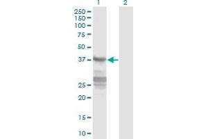 Image no. 2 for anti-Calponin 3, Acidic (CNN3) (AA 1-329) antibody (ABIN947715)
