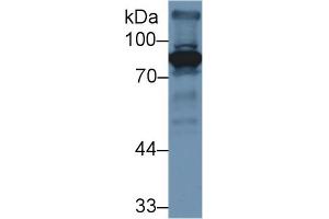 Image no. 2 for anti-Coagulation Factor II (thrombin) (F2) (AA 201-324) antibody (ABIN1858752)