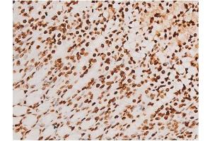 Image no. 4 for anti-Spleen tyrosine Kinase (SYK) (pTyr348) antibody (ABIN6255895)