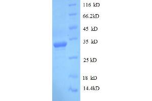 Image no. 1 for delta-Like 1 Homolog (Drosophila) (DLK1) (AA 24-303) protein (His tag) (ABIN5709405)