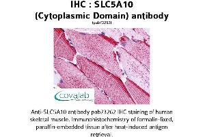 SLC5A10 抗体  (Cytoplasmic Domain)