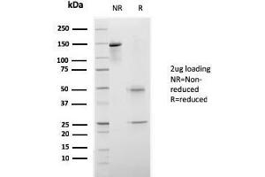 Image no. 1 for anti-Elastase 3B, Pancreatic (ELA3B) (AA 82-238) antibody (ABIN6939416)