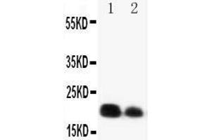 Image no. 1 for anti-Interleukin 6 (IL6) (AA 195-211), (C-Term) antibody (ABIN3042620)