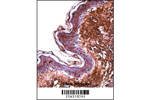 PPT2 Antibody immunohistochemistry analysis in formalin fixed and paraffin embedded human skin tissue followed by peroxidase conjugation of the secondary antibody and DAB staining.