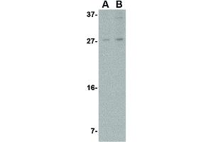Image no. 3 for anti-Mesencephalic Astrocyte-Derived Neurotrophic Factor (MANF) (N-Term) antibody (ABIN6656565)