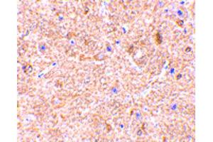 Image no. 5 for anti-Mitochondrial Antiviral Signaling Protein (MAVS) (Internal Region) antibody (ABIN6657099)