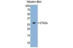 Image no. 1 for anti-FK506 Binding Protein 3, 25kDa (FKBP3) (AA 2-224) antibody (ABIN1078042)