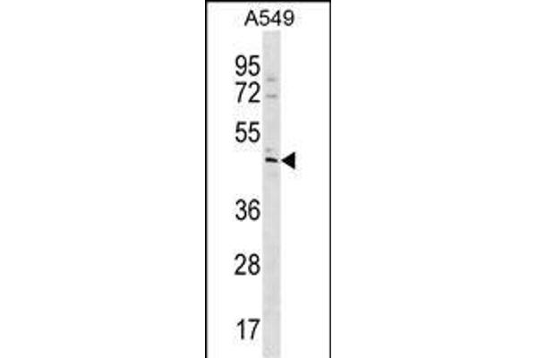TBC1D20 抗体  (C-Term)