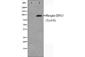 Image no. 2 for anti-Epidermal Growth Factor Receptor Pathway Substrate 15 (EPS15) (pTyr849) antibody (ABIN6256811)