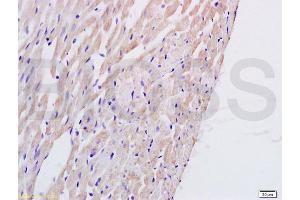 Formalin-fixed and paraffin embedded rat heart tissue labeled with Anti-PTAFR Polyclonal Antibody, Unconjugated (ABIN687127) at 1:200 followed by conjugation to the secondary antibody and DAB staining