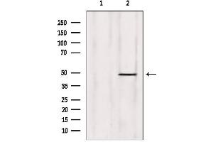 anti-Zinc Finger Protein 174 (ZNF174) (Internal Region) antibody