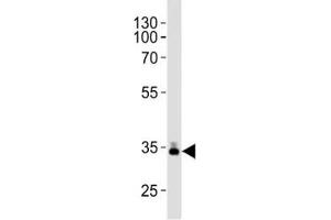 Image no. 2 for anti-Apolipoprotein E (APOE) (AA 263-292) antibody (ABIN3029997)