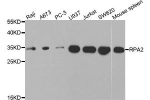 Image no. 4 for anti-Replication Protein A2, 32kDa (RPA2) antibody (ABIN3023166)