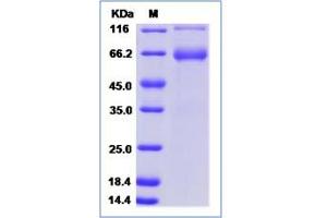 Image no. 1 for Inter alpha Globulin Inhibitor H3 (ITIH3) (AA 1-651) protein (Fc Tag) (ABIN2006743)