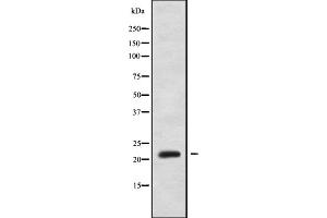 Image no. 1 for anti-GAR1 Ribonucleoprotein Homolog (Yeast) (GAR1) (Internal Region) antibody (ABIN6263690)