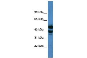 Image no. 3 for anti-Cytochrome P450, Family 21, Subfamily A, Polypeptide 2 (CYP21A2) (C-Term) antibody (ABIN2788351)