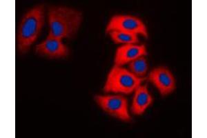 Image no. 1 for anti-MOK Protein Kinase (MOK) (Center) antibody (ABIN2706580)