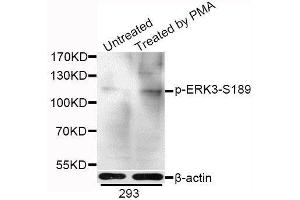 Image no. 2 for anti-Mitogen-Activated Protein Kinase 6 (MAPK6) (pSer189) antibody (ABIN3019482)