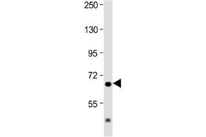 Image no. 1 for anti-Interleukin 1 Receptor Accessory Protein (IL1RAP) (AA 484-518) antibody (ABIN5647163)