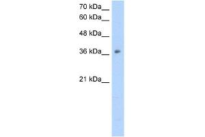 Image no. 1 for anti-Ornithine Carbamoyltransferase (OTC) (N-Term) antibody (ABIN2773791)