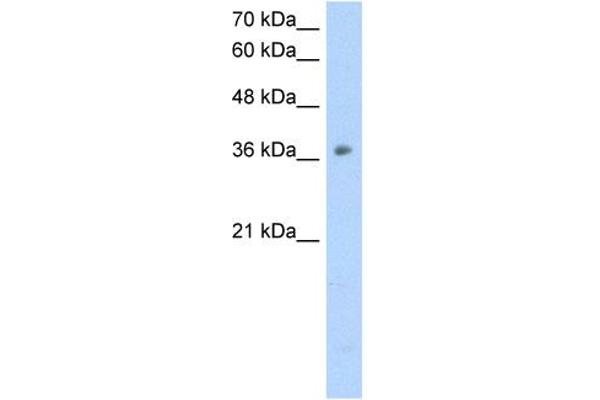 OTC antibody  (N-Term)