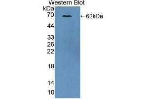 Image no. 2 for anti-Cytoskeleton Associated Protein 2 (CKAP2) antibody (ABIN5013435)