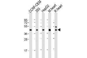 Image no. 2 for anti-Vascular Endothelial Growth Factor C (VEGFC) antibody (ABIN659094)