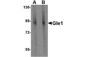 Image no. 2 for anti-GLE1 RNA Export Mediator (GLE1) (C-Term) antibody (ABIN499892)