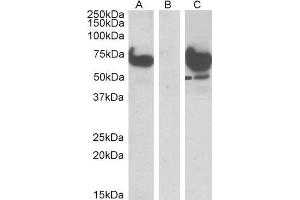 Image no. 1 for anti-EPM2A (Laforin) Interacting Protein 1 (EPM2AIP1) (N-Term) antibody (ABIN5539635)