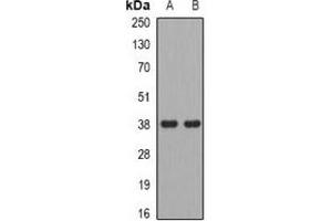Image no. 2 for anti-Alcohol Dehydrogenase 5 (Class III), chi Polypeptide (ADH5) antibody (ABIN3197864)