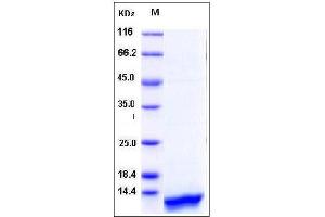 Image no. 1 for Chemokine (C-C Motif) Ligand 14 (CCL14) (AA 20-93), (Mature) protein (His tag) (ABIN2002923)