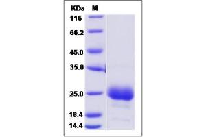 Image no. 1 for CD160 (CD160) (AA 1-158) protein (ABIN2010012)